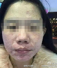 90后网络红人卖毒面膜,还是留学回来的