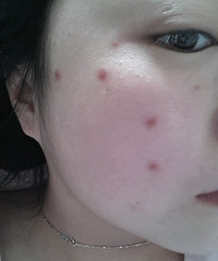凡凡的抗过敏经验~献给论坛的美女们!!希望对大家有一点点帮助~