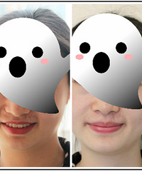 体验重庆最划算的脱毛,美仑美奂99元包干脱毛归来!