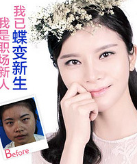 两人拼单变美, 美眼、美鼻、痘痘、祛斑仅需半价