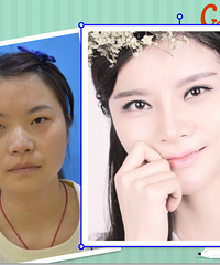 眼睛大了、鼻子挺了、脸庞瘦了,整容后我差点忘记了原来的样子
