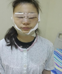 眼睛大了、鼻子挺了、脸庞瘦了,整容后我差点忘记了原来的样子
