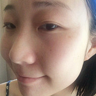 一个星期痘印就消了