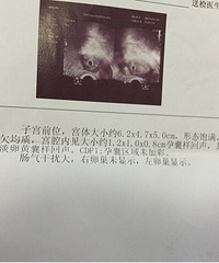 吃西药副作用明显,双侧多囊转战中医后怀上宝宝【备孕历程】