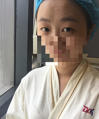 纠结了这么久,终于下定决心去整双眼皮了