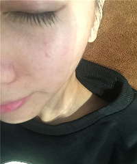 【MIHO米荷美睫】皮肤深层毛孔清归来啦啦啦啦