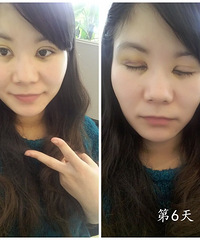 �ҵ�˫��Ƥ�����۽ǻָ�+���� ��¼�������Լ��Ļ��䣡��