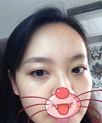 终于鼓起勇气做了韩式半永久性纹眉,效果很满意