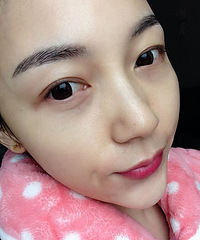 �ܹ�ֱ��ע��ˮ����ȫ���̣����Ǹ���Ƥ��ˮ�ۻ��Ŀ����ؾ�