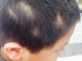 头发被同学剪成这样