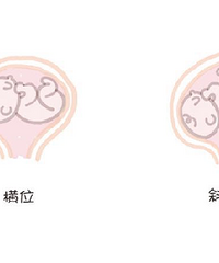 教准妈妈们自己看懂B超单,专业名词解释以及对应周数的B超值。