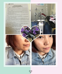 “只要青春,不要痘”~真伊祛痘养颜术体验归来