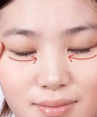 【美禅整形告诉你】你的眼型适合什么眼部整形术?