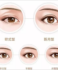 切开双眼皮的手术原理、术后护理及常见问题