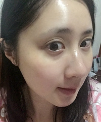 等了两个月的spa蛇毒眼膜终于到了