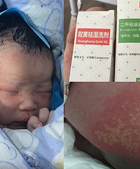 孕期没吃鹅蛋去胎毒,害得宝宝长红斑