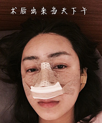 �����ۺϹ���������¶Ա�ͼ������֬�����̫��Ѩ��