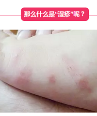 高温来袭,婴儿湿疹预防要抓紧!