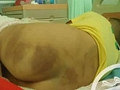 3岁男童被爸爸压马桶