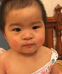 帮忙看看这是是长的什么啊……娃儿上前天突