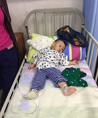 小儿先天腱鞘炎手术记录,需要做全麻