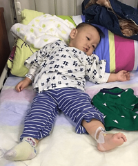 才去做了腱鞘炎手术