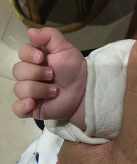 ��û�еù�������խ�������׵ı�������Ĺ����