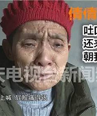 重庆八岁女孩突然身亡,原因竟是半年前被狗咬伤!