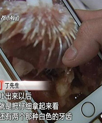小伙买黄焖鸡米饭吃出“怪物”,浑身毛茸茸还长牙