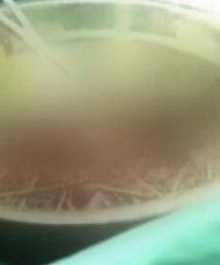 初三学生长期遭同学欺凌,吞了1.4斤铁钉欲自杀