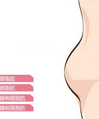 重庆美禅分享自体丰胸的利弊