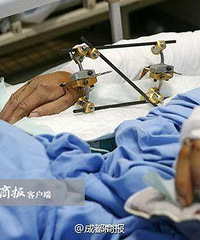饲养员被大熊猫咬成重伤,脚筋腕骨均被咬断
