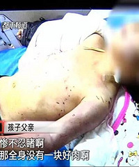 只因和奶奶太亲近,4岁女孩被亲妈虐待致死