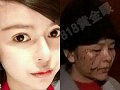 她整容后被闺蜜毁容