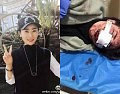 女子丽江旅游惨被毁容