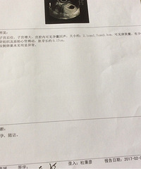 还愿,接胎心胎芽啦