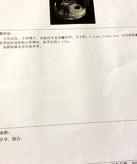 特来还愿,接胎心胎芽啦