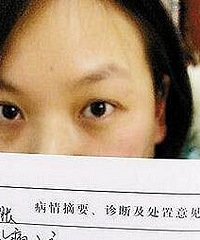 女白领长满眼结石,万万没想到原因是……