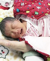 女婴早产仅3斤3两,治疗1个月将花5万元