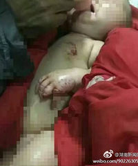 痛心!衡阳四个月苦难婴儿睡狗窝,被咬掉两手指
