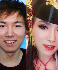 只需简单一步,铁锈氟斑牙女孩重获灿烂笑容