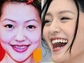 大小S牙齿是整出来的