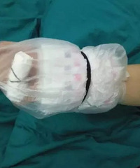 P大点儿伤口,男朋友给我包成这样...