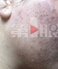 重庆美女美容搞出大麻烦,已经无脸上街...