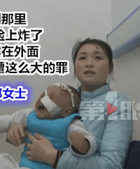 触目惊心!一岁幼儿左脸及鼻翼被削掉,慎入