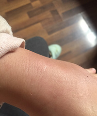 ���׵�����