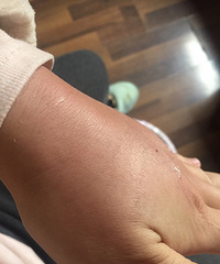 ���׵�����