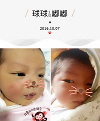 二娃诞生记~一剖二剖其实并没有想象中那么痛~