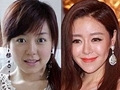 过气超女整容变僵尸脸