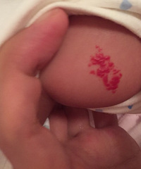 Ѫ������ô��